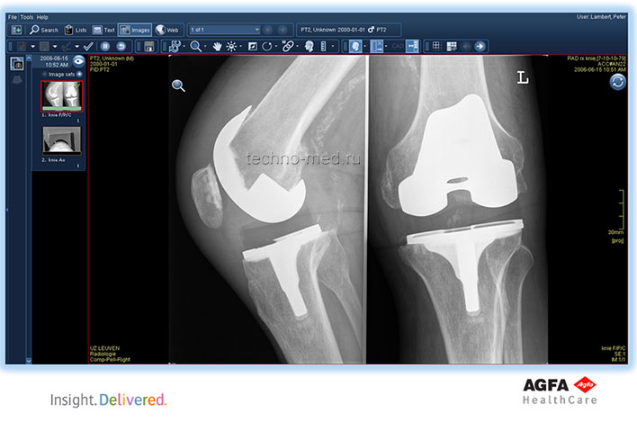 Область изображения на рабочем столе отдела диагностики IMPAX Agility
