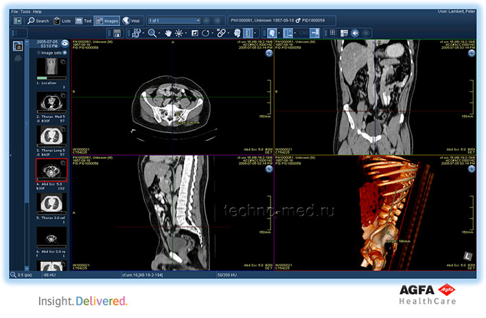 Трехмерные метки на экране АГФА ИМПЭКС Аджилити